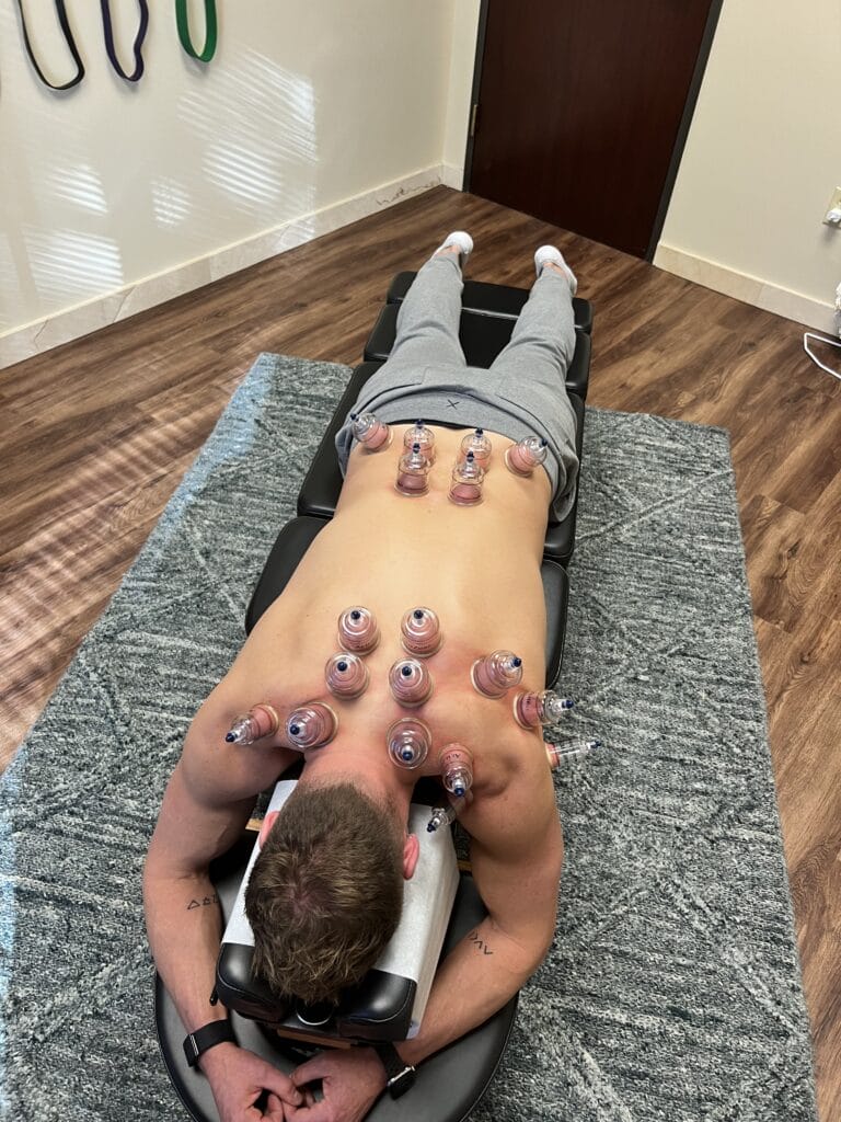 cupping back